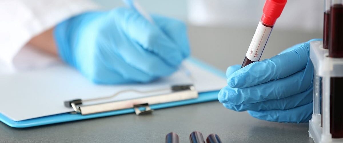 Descubre cómo un análisis de sangre de bajo costo puede revolucionar la detección de cáncer y enfermedades.