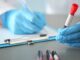 Descubre cómo un análisis de sangre de bajo costo puede revolucionar la detección de cáncer y enfermedades.