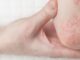 Las enfermedades como lupus y psoriasis aumentan el riesgo de cáncer, revelando un desafío oculto en la cultura pop.